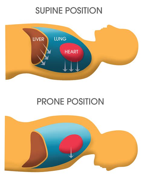 prone k tube|The Pragmatics of Prone Positioning .